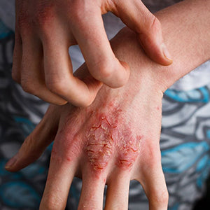 Manjishthadi Kashayam Tablet | Skin Brightness & Blood Purification | Riddhish Herbals | 60Tab.