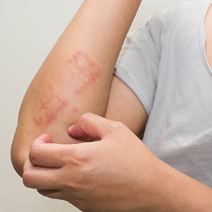 Pratirakshak Ukalo Dry 100GM | RIDDHISH HEBALS