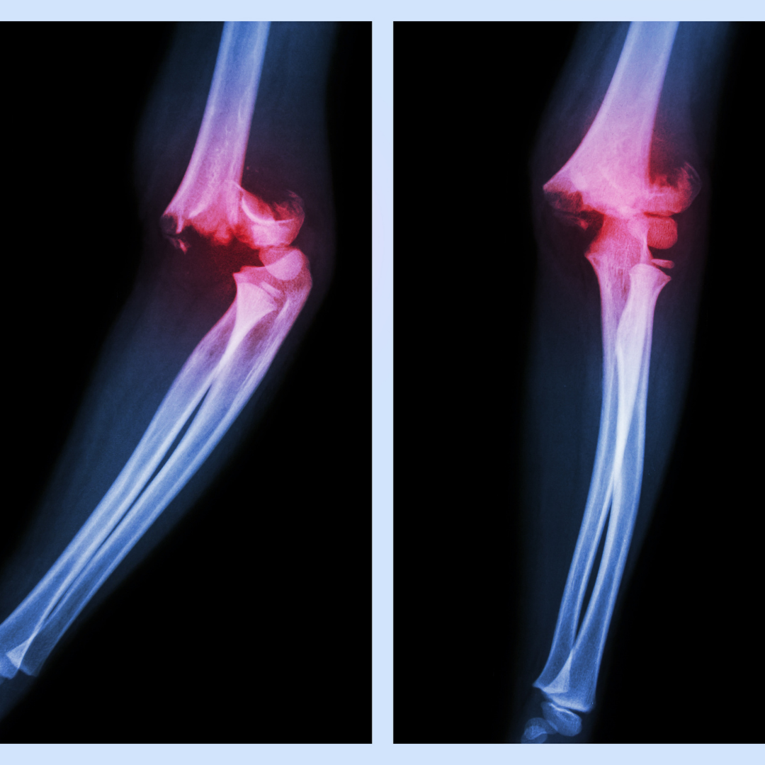 ABHA GUGGULU 60 TAB NAGARJUN | Bone and Joint Health Support
